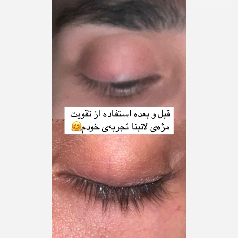 لوسیون تقویت مژه اصل اورجینال سرم تقویتی مژه ها و ابرو پرپشت کننده ضد ریزش بلند کننده ضخیم کننده مژه ها و ابرو ها چشم